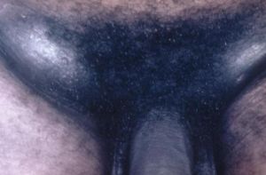 92