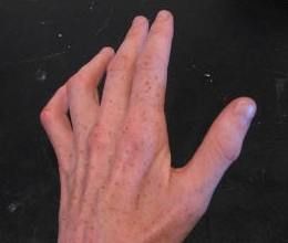 81