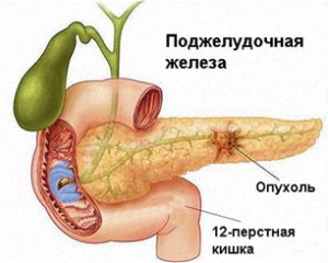 115